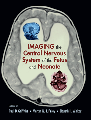 Read Imaging the Central Nervous System of the Fetus and Neonate - Paul D. Griffiths file in PDF